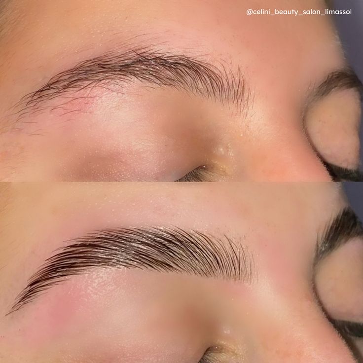 put this oil and youll see how fast will grow your hair eyelashes and eyebrows